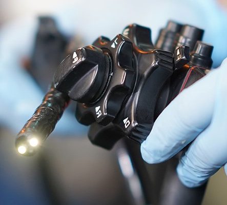 Schwarzer medizinischer Endoskopgriff mit Lichtern, gehalten von einer handschuhgetragenen Hand.